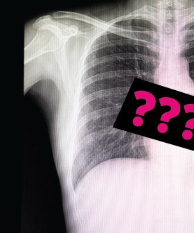 The "X-Ray Reveal" Stories That Are Too Bonkers To Believe