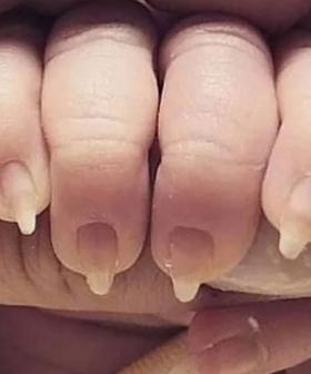 The Internet Is Up In Arms Over This 'Trashy' Photo Of A Baby's Fingernails