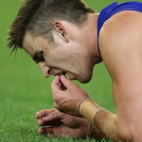 Why Elliot Yeo Wasn't Wearing A Mouthguard During THAT Match Where He Lost His Teeth